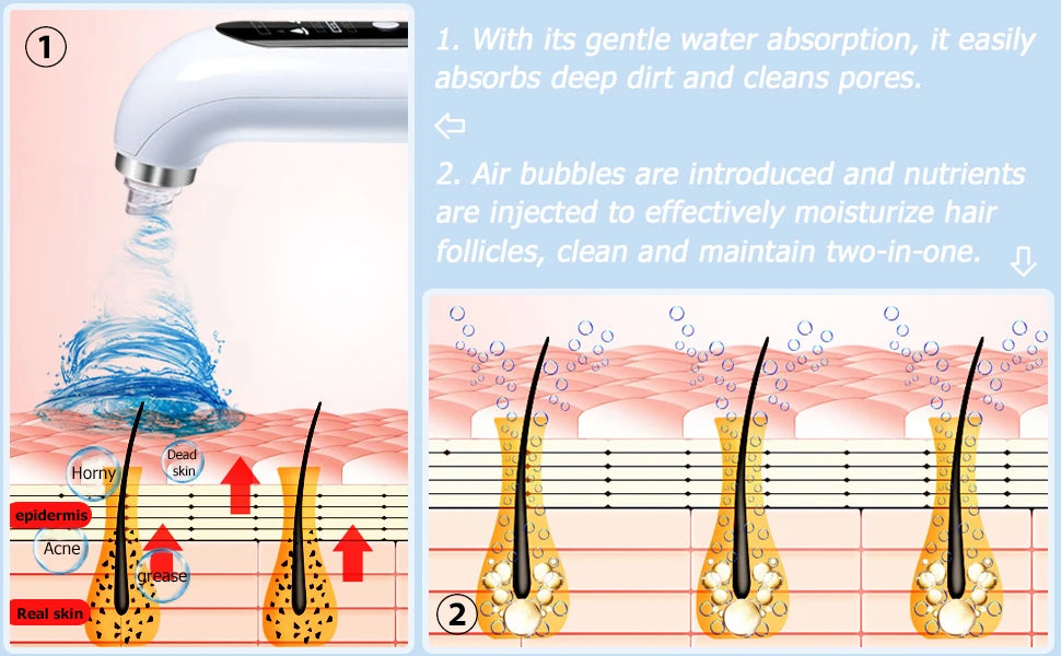 Aspirateur électrique pour pores