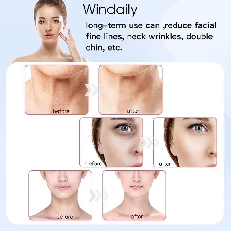 Appareil de Lifting du visage et du cou