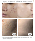 Masque LED Rechargeable à 7 couleurs